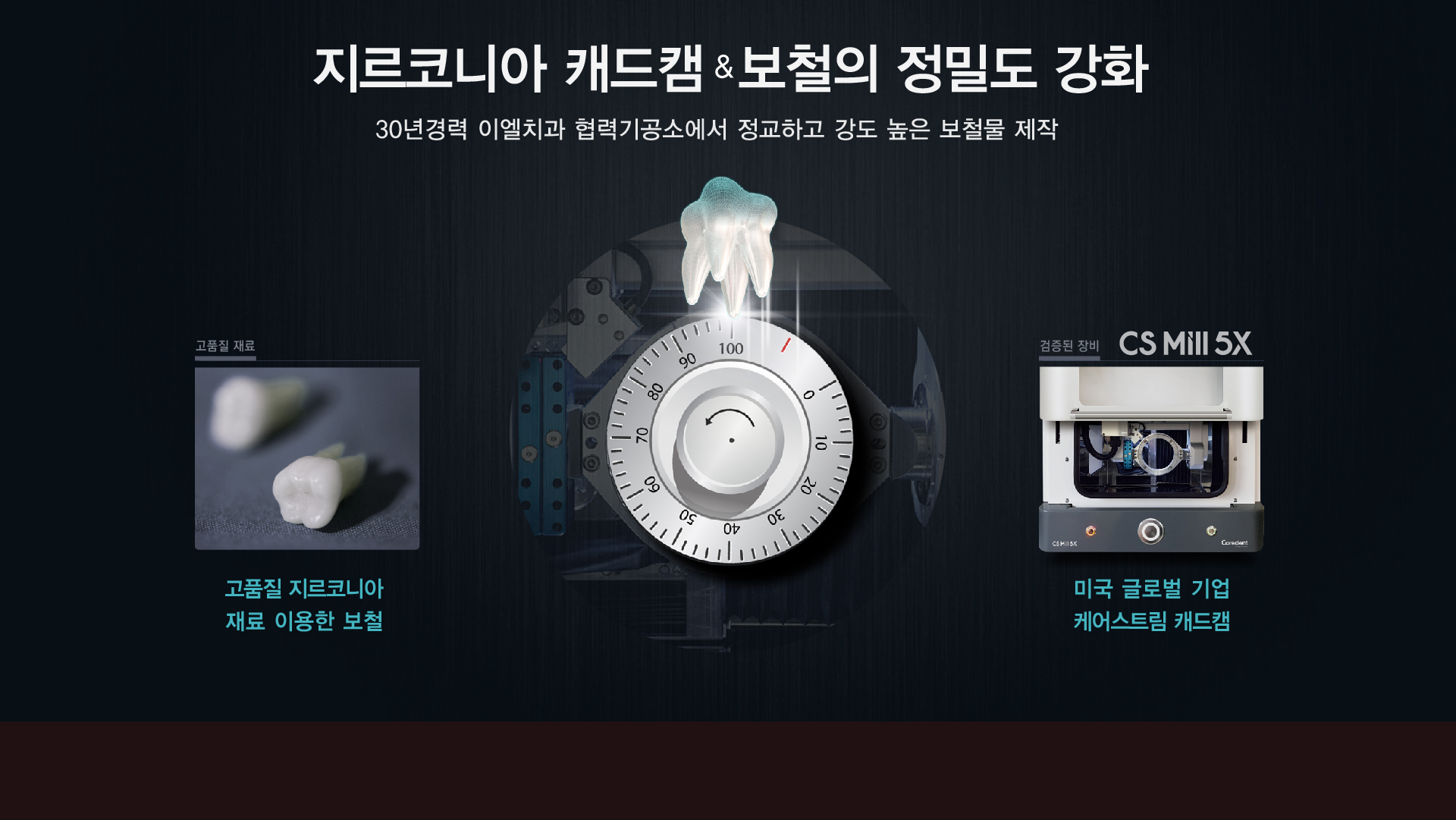 지르코니아 캐드캠 보철의 정밀도 강화