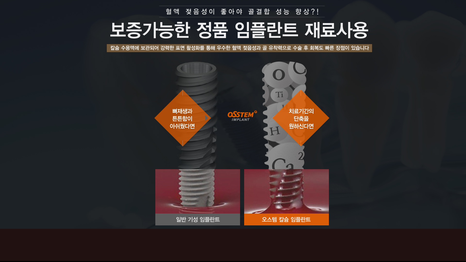 혈액 젖음성이 좋아야 골겹합 성능 향상 신개념 명품 임플란트