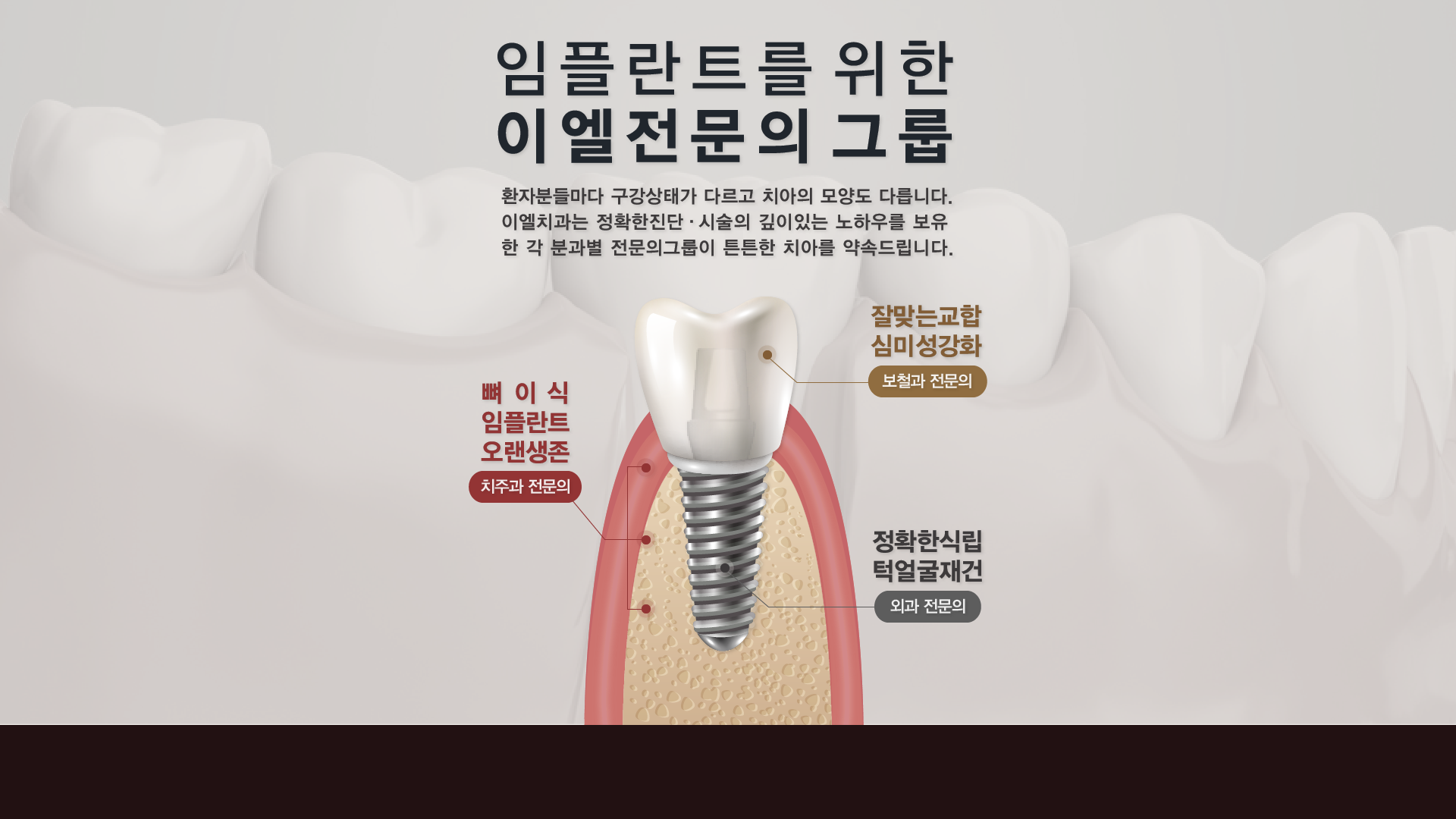 임플란트를 위한 이엘전문의 그룹