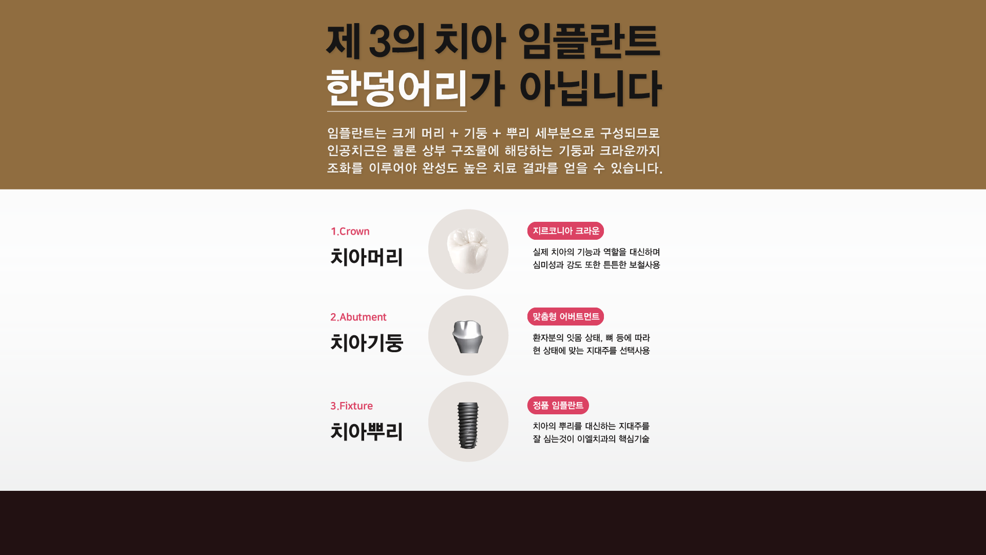 제 3의 치아 임플란트 한덩어리가 아닙니다.